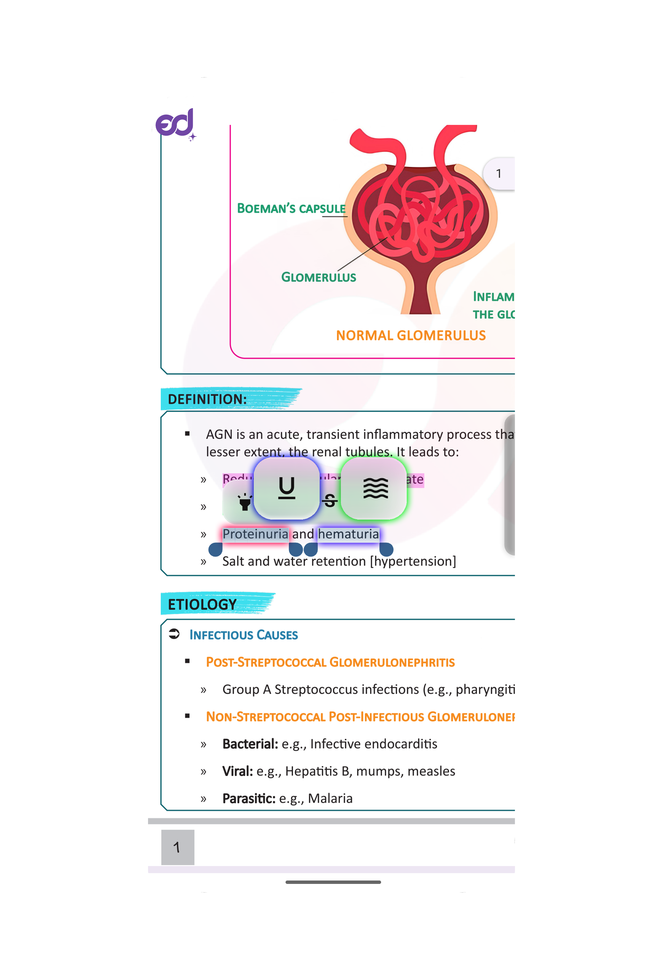 Underline & Squiggly Options