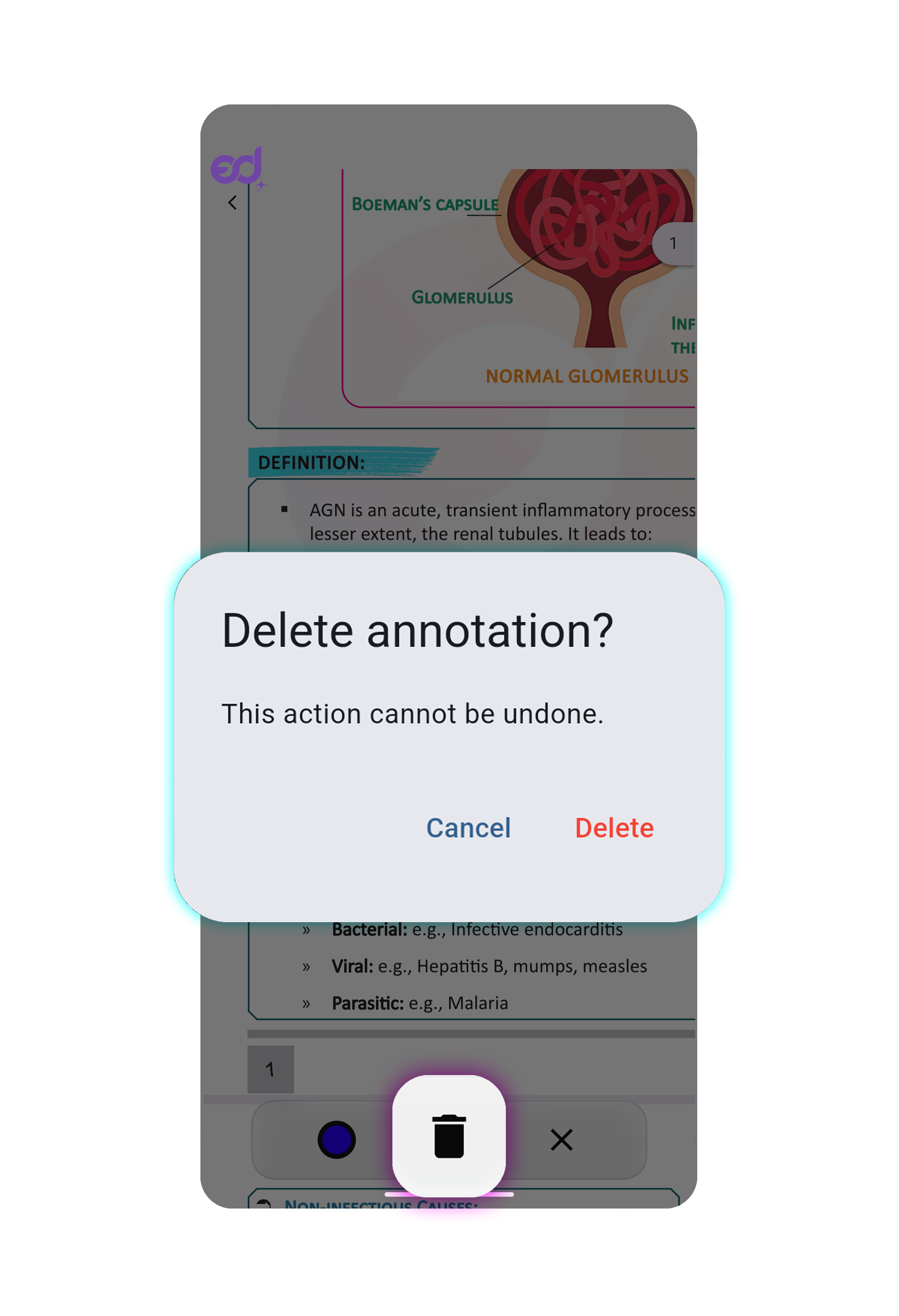 Delete Annotation