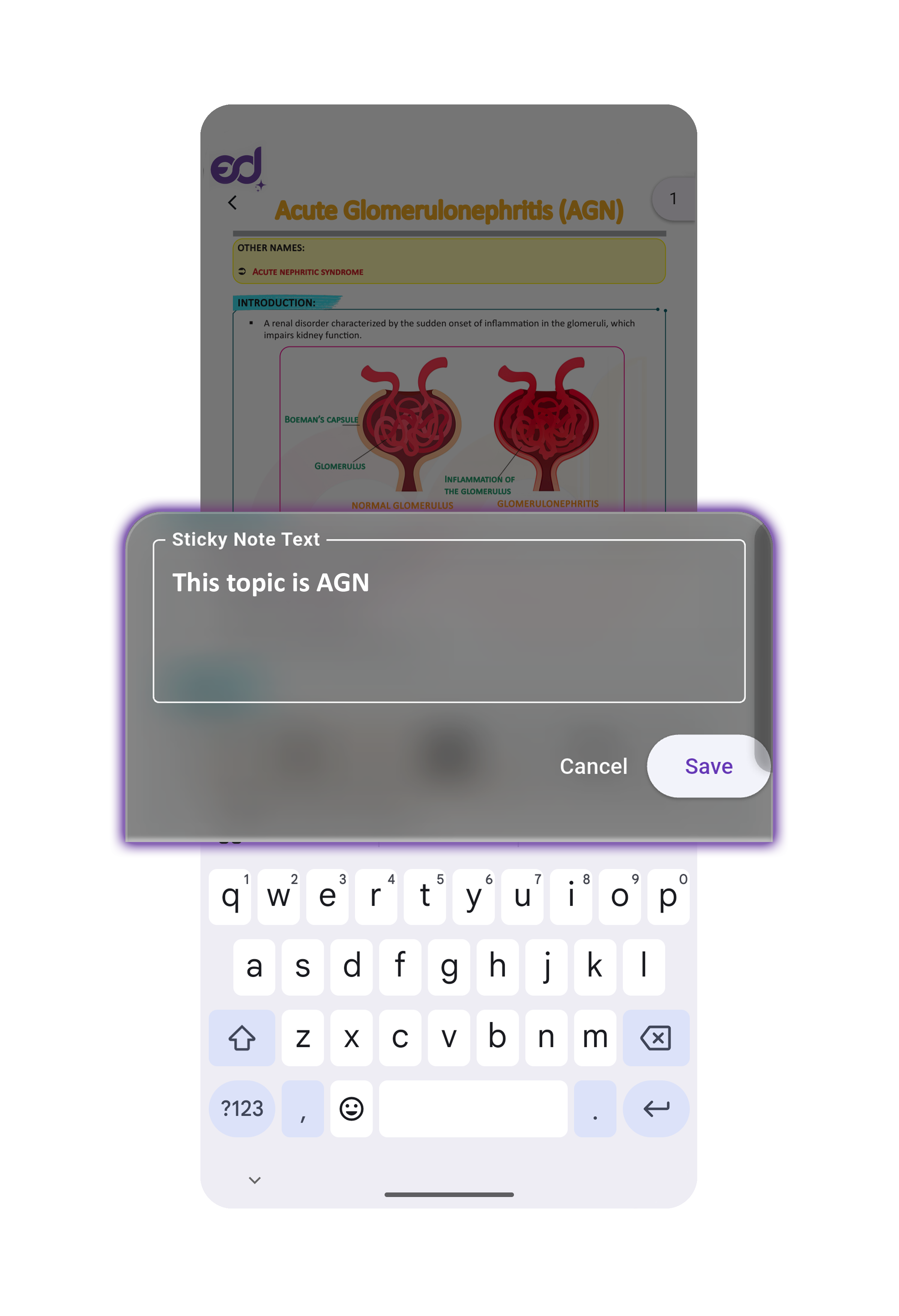 Sticky Note Re-edit Type 1